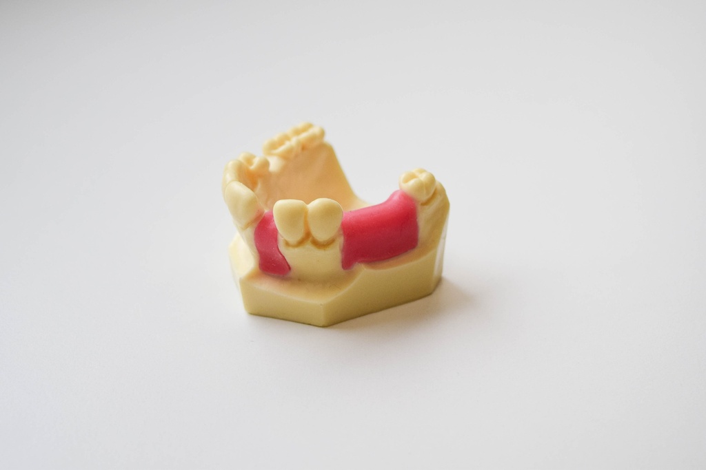 MODELO DESDENTADO PARCIAL PARA PRÁCTICA DE IMPLANTES ENCÍA PARCIAL