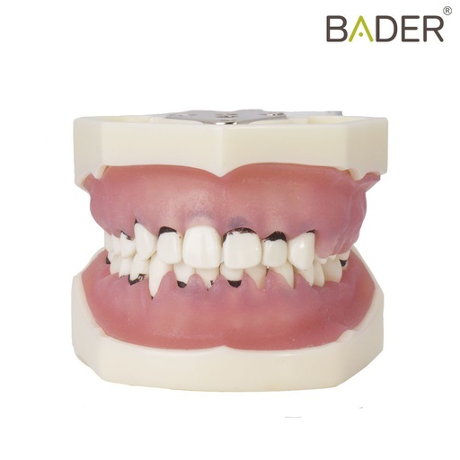 [0905110] MODELO DE PERIODONCIA CON ARTICULADOR